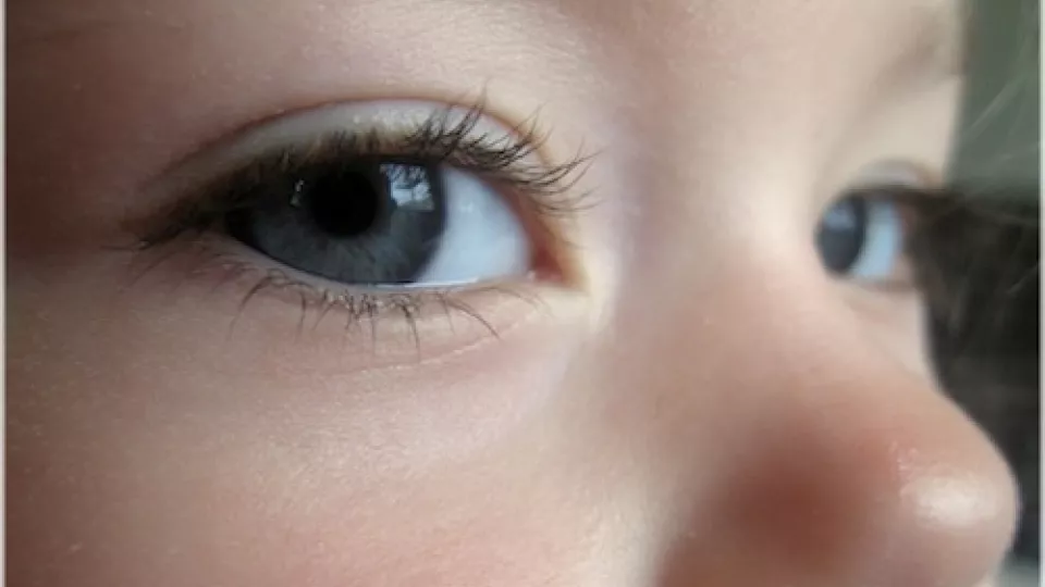 Research shows former childhood cancer patients’ eye movement is affected by treatment. Photo: B. Brenneman