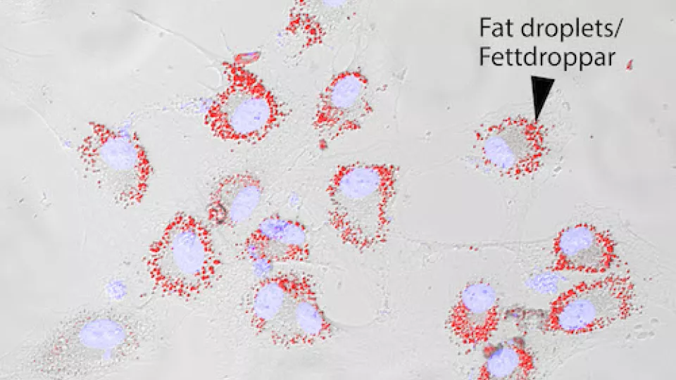 The cell images represent cancer cells where the cell nuclei are depicted in light blue and the fat droplets in red. Photo: Belting's Research Group