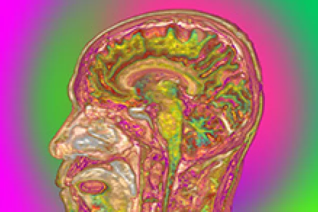 colourful brain scans