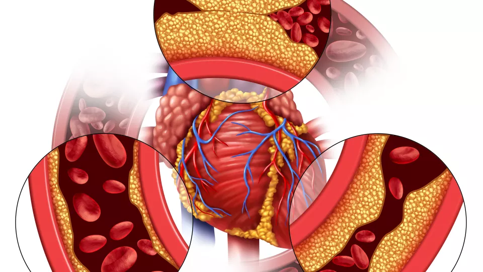 Illustration of heart, arteries