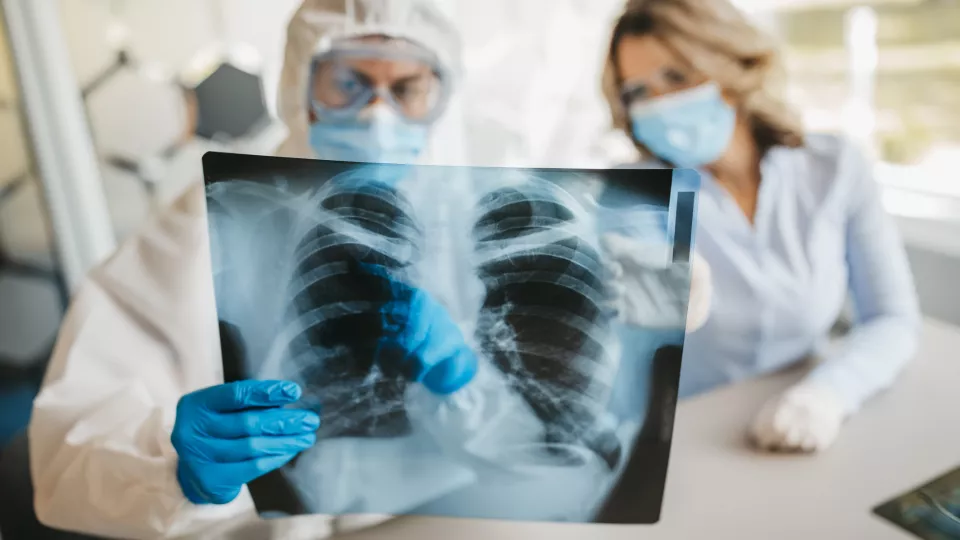 Doctors looking at chest x-ray
