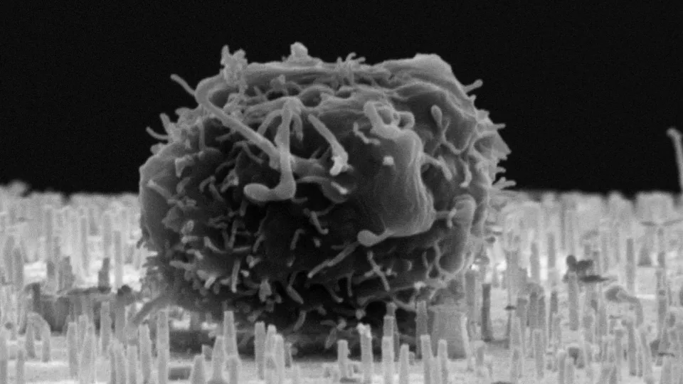 Electron microscope image shows a blood stem cell on top of a membrane of nanotubes (Image: M. Hjort and L. Schmiderer)