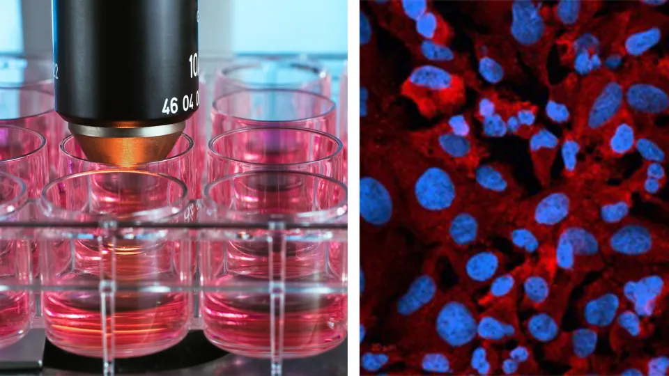 To the left: Petri dishes for cell cultures in the lab. To the right: Cells from the cell line the researchers used in the study. Photo.