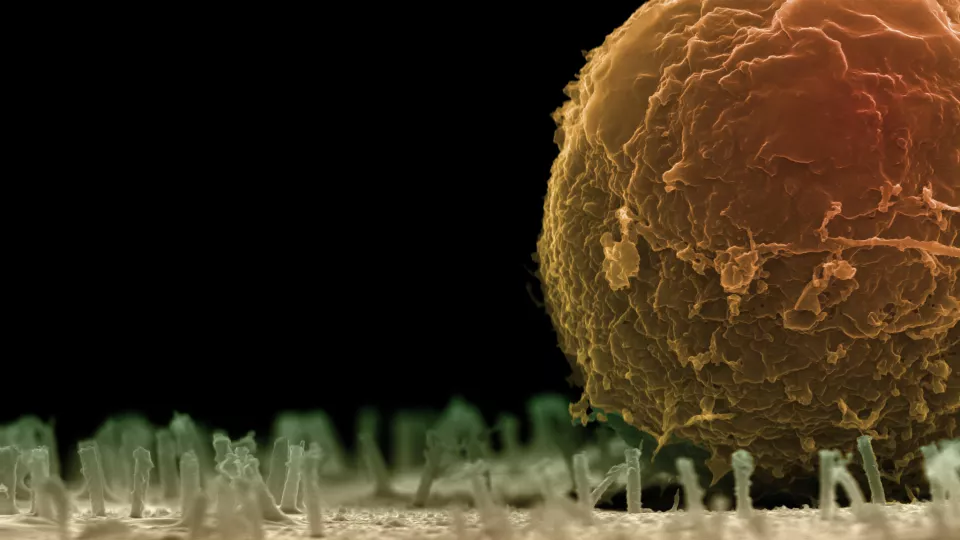 Nanotubes act like a Velcro strip to which the blood stem cell sticks. Photo: Martin Hjort.