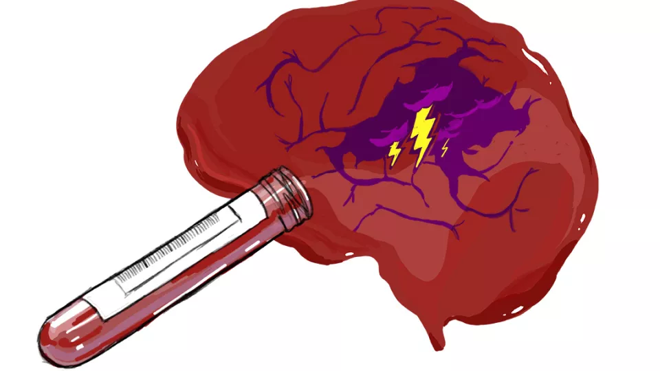 Illustration of a brain and a vial of blood