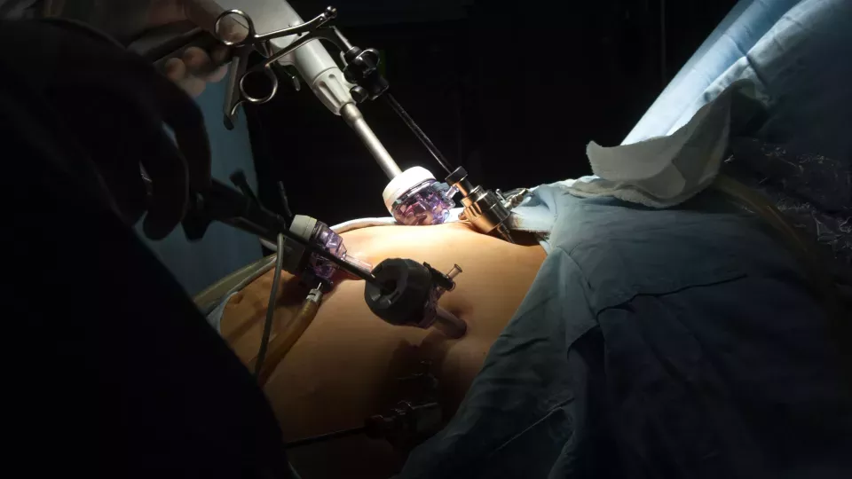 Photo of person undergoing gastric bypass surgery