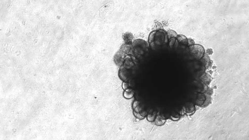 Brain organoid, photography. Photo: Anita Adami