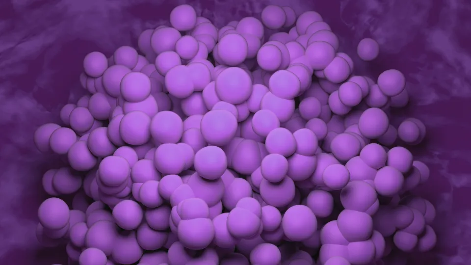 An image of a glioblastoma tumour. Photo: iStock