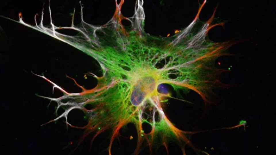 Astrocytes grown from embryonic stem cells (Photo: Isaac Canals)