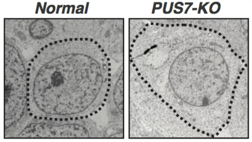 High-resolution electron microscopy images illustrate significant differences in cell size between a normal (left) and PUS7-deficient (PUS7-KO, right) human embryonic stem cell.