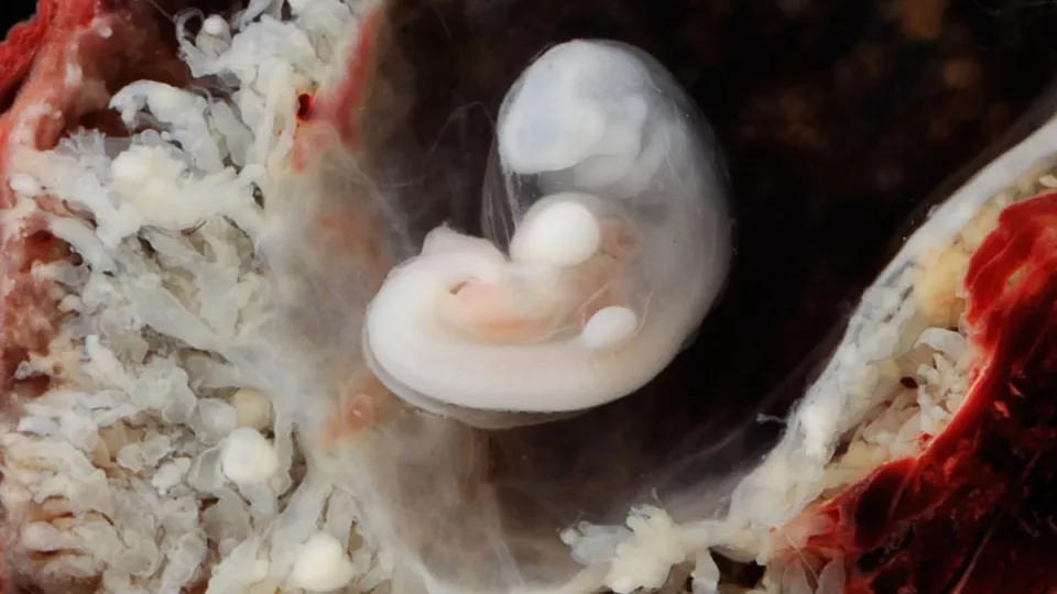 Image of a human embryo surrounded by placenta, around 7 weeks of age. (Hill, M.A. (2020, May 18) Embryology Stage13 bf4.jpg. Retrieved from https://embryology.med.unsw.edu.au/embryology/index.php/File:Stage13_bf4.jpg)