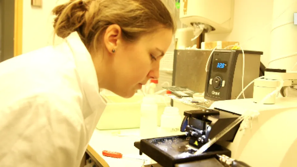 Human brain tissue studied