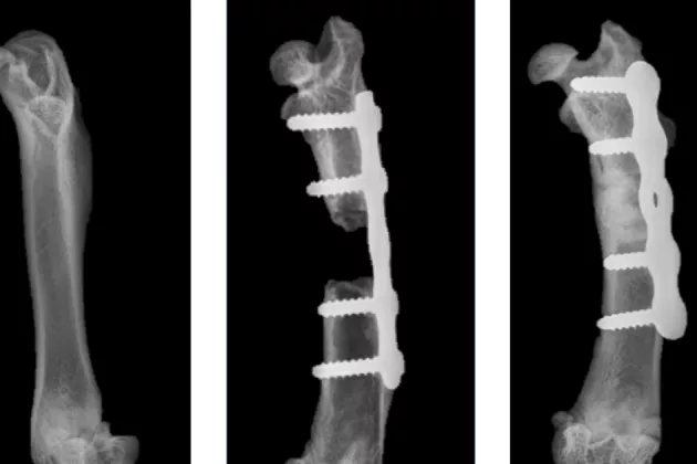 X-ray image of thigh bones