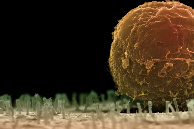 Nanotubes act like a Velcro strip to which the blood stem cell sticks. Photo: Martin Hjort.