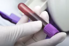 A vial of blood