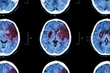 Researchers have succeeded in restoring lost brain function in mouse models of stroke (Image: iStock)