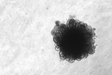 Brain organoid, photography. Photo: Anita Adami