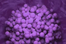 An image of a glioblastoma tumour. Photo: iStock