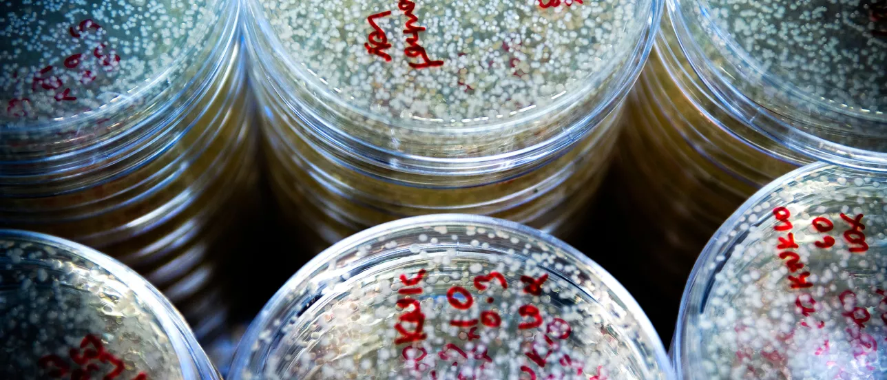 Petri dishes with samples in them and red writing on them