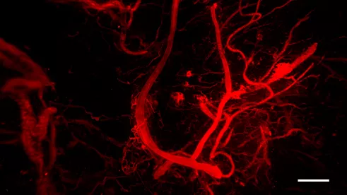 Blood vessel infiltration in the 3D bioprinted constructs.