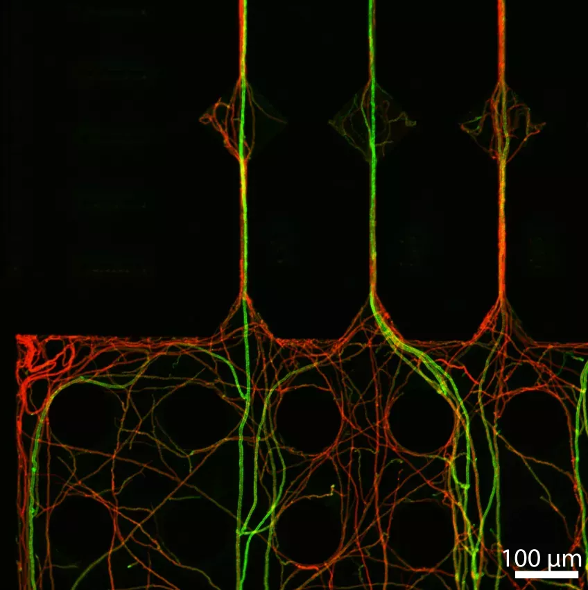 The fungus (in red) collected all of the green plastic nanoparticles onto the first fungal threads encountering the polluted area, and cleaned up its surroundings.