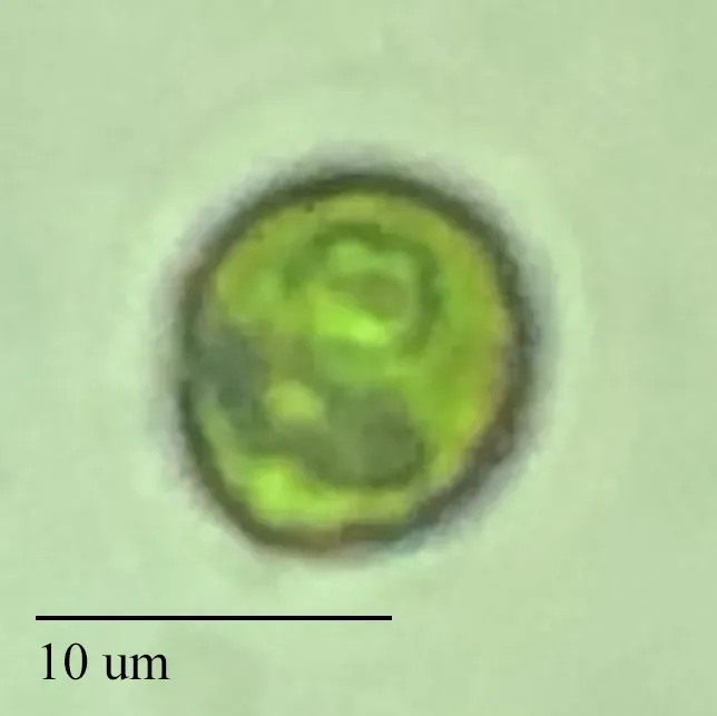 Green algal cell from Lake Krageholmssjön.