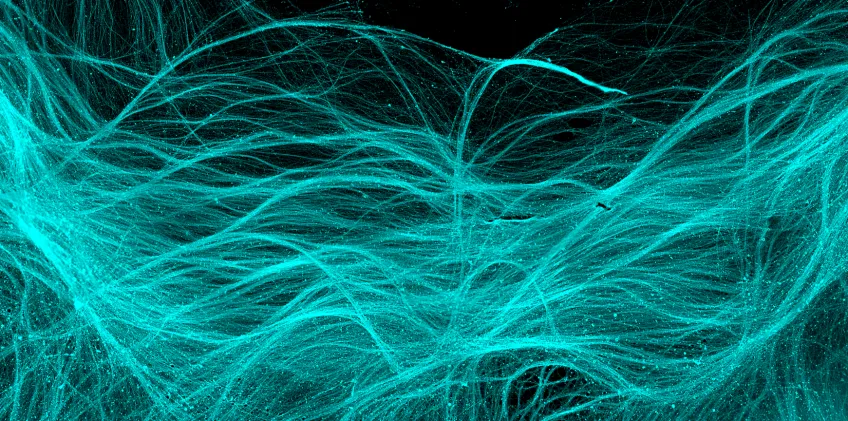 Fibres from dopamine neurons grown in cell culture. Photo: Kirkeby lab, ReNew, Copenhagen Dopamine neurons grown in 3D in culture. (Photo: Parmar lab, Lund University, Sweden)