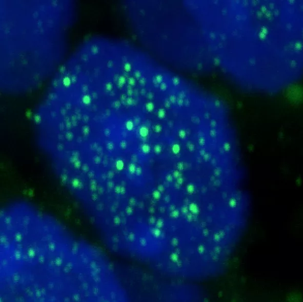 The immunofluorescence image shows the location of the RNA-modifying enzyme PUS7 (green dots) within the nucleus (blue) of a human embryonic stem cell.