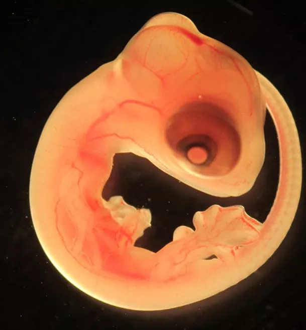 A common wall lizard embryo (Photo: Nathalie Feiner)